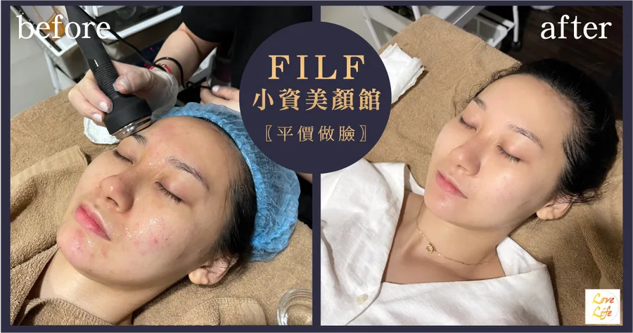 【台南美容spa】FILF小資美顏館│美容方案自由配│大學生推薦平價做臉│小資族首選做臉│高CP值 東區美容推薦