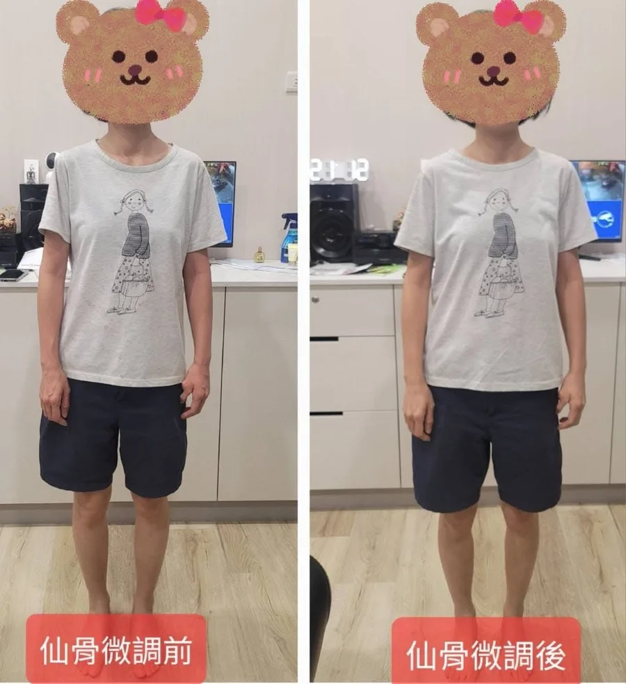 台南整復推薦｜肩頸痠痛、偏頭痛長年困擾，靠溫和仙骨調理終於改