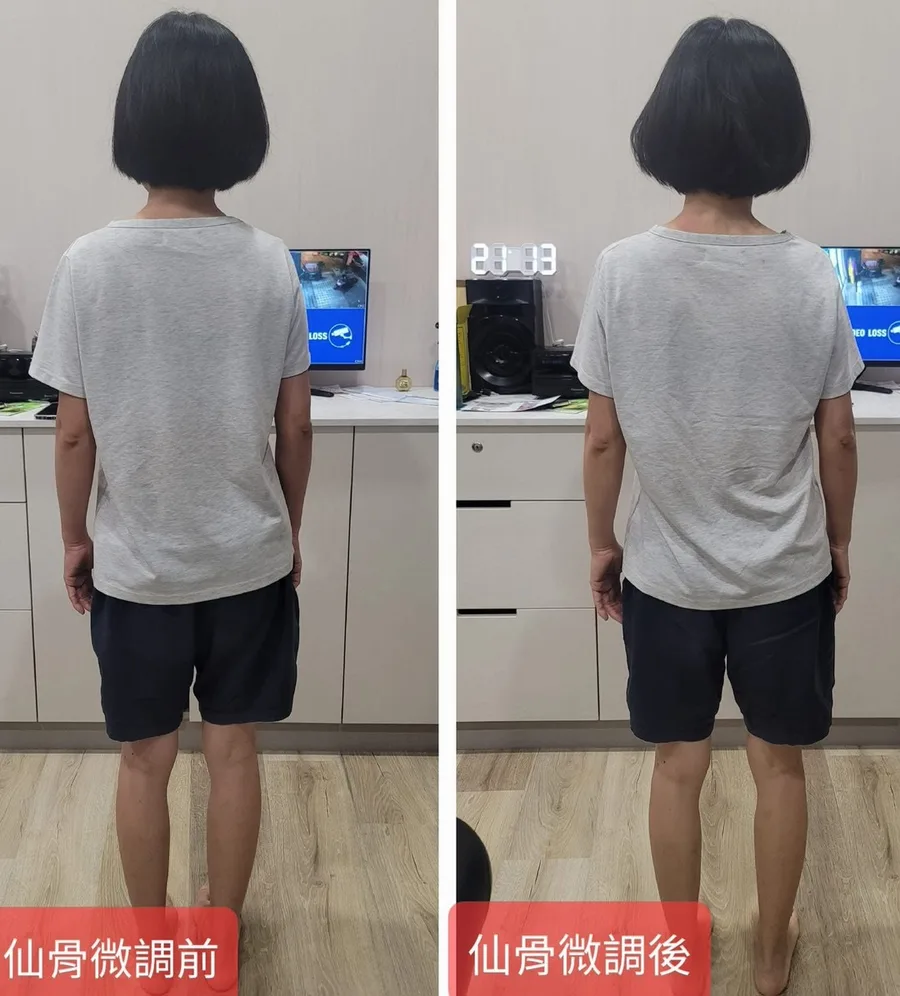 台南整復推薦｜肩頸痠痛、偏頭痛長年困擾，靠溫和仙骨調理終於改